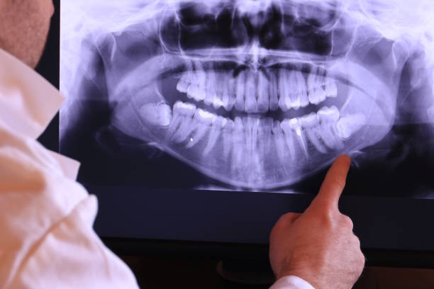 Best Emergency Treatment for Dental Infections or Abscesses in Greenville, RI